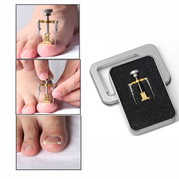 

вросший toe nail recover инструмент педикюр ноготь fixer педикюр ног уход за ногтями nail ingrowing onyxis мозолей корректор для toes