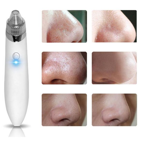 Электрический очиститель пор Acne Blackhead Remover Устройство для ухода за кожей Пылесос с вакуумом USB Аккумуляторная Comedo Всасывающая очиститель для лица