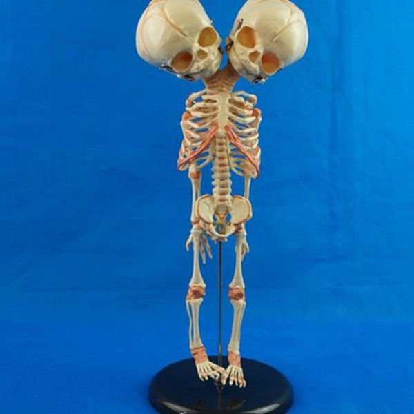 

14.5" or 37cm human new double head baby skull skeleton anatomical brain silicone anatomy education model anatomical study display anat