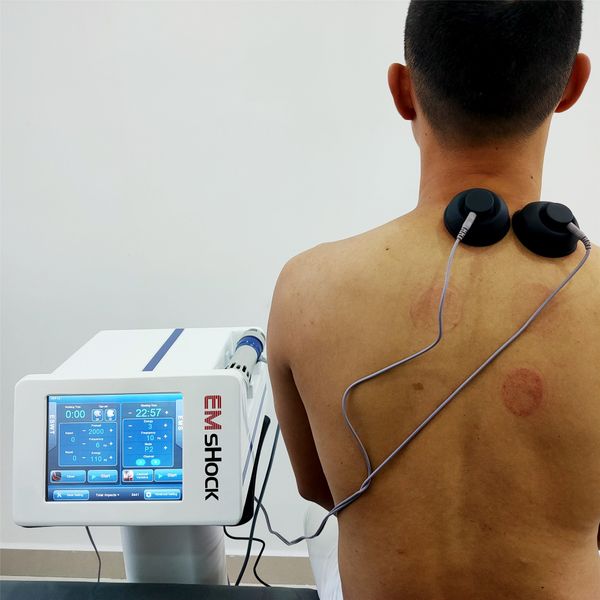

electric muscle stimulation extracorporeal shock wave therapy acoustic wave shock wave eswt therapy for ed tratment