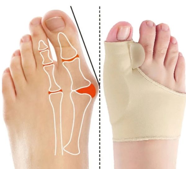 bunion corrector hallux valgus braces big toe orthopedic correction socks toes separator feet pain protect relieve bone thumb sleeve p211-1, Black