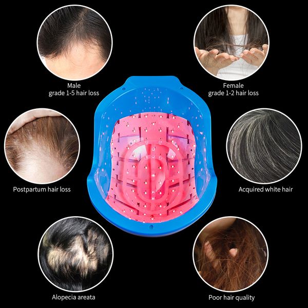 Casco per la ricrescita dei capelli laser ricaricabile 678nm Cappuccio laser per estensione a bassa luminosità Trattamento della cuffia per la ricrescita dei capelli Attrezzatura per massaggio