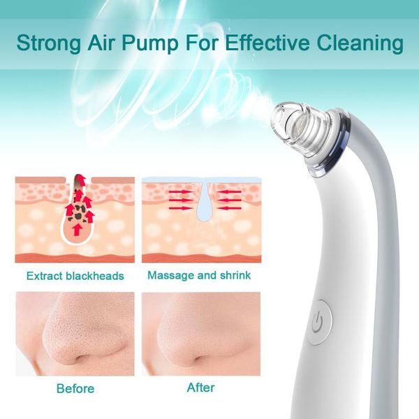 

4 in 1 skin pore cleaner vacuum blackhead removal inhaler suction wrinkle black remover extractor skin care tools