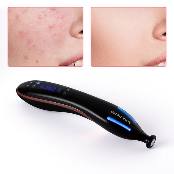 

portable high frequency acne meter skin care spa plasma pen skin rejuvenation plasma acne scar freckle removal beauty machine