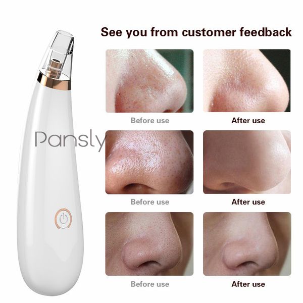 

face nose acne black dot spots pimple blackhead remover electric blackhead vacuum cleaner pore blackhead skin care tools machine