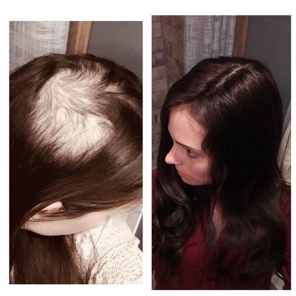 2020 Stock Natural Silk Base Human Hair Toppers For Women 2 5 5