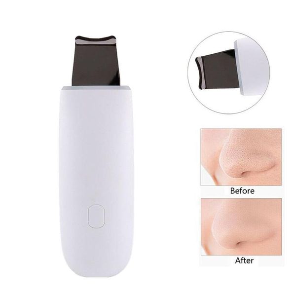 

ultrasonic facial skin scrubber pore deep cleansing vibration peeling off