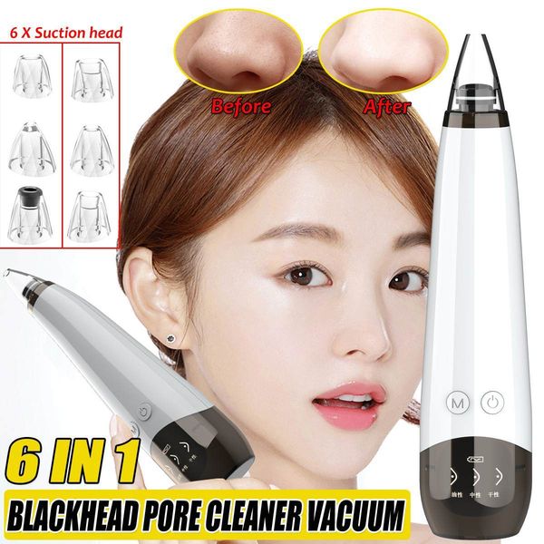 

6 suction heads blackhead acne remover vacuum pore cleaner acne blackhead facial removal suction machine skin care tool