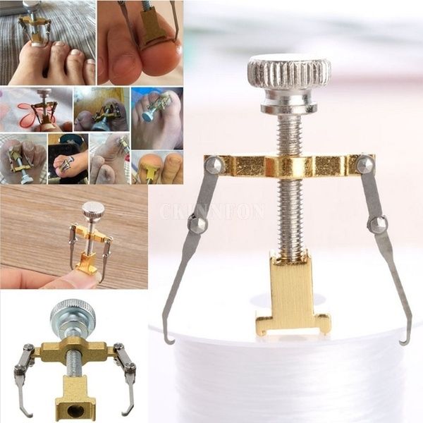 

dhl 100pcs ingrown toe nail correction pedicure fixer straightener clippers recover set clamp scissors nail correction device