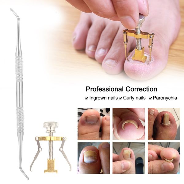

2pcs ingrown toe nail correction set tool stainless steel ingrown toenails manicure pedicure nail file clean care tool, Silver