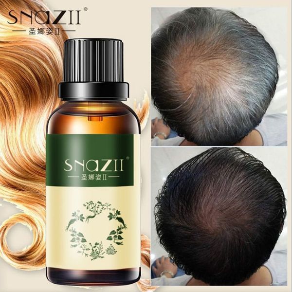 

30ml 1 bottle hair care growth liquid essence oil hairs growth prevention hair loss essential oil plant hair for men women tslm2
