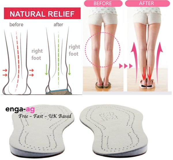 

pronation eva leather orthopedic insoles for flat foot arch support shoes pad correct o x leg valgus varus shoe palmilha insole, Black