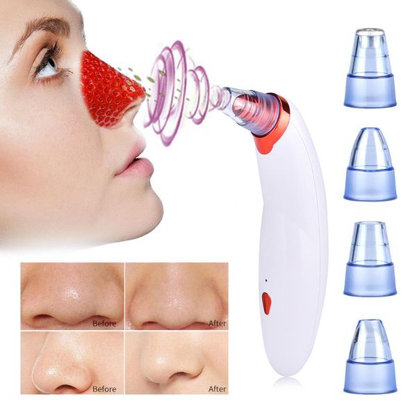 

body cupping blackhead remove vacuum suction face clean pore vacuum acne pimple removal facial diamond dermabrasion tool machine