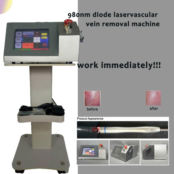 

medical apparatus vascular laser treatment laser to remove broken blood vessels on face broken capillary laser treatment
