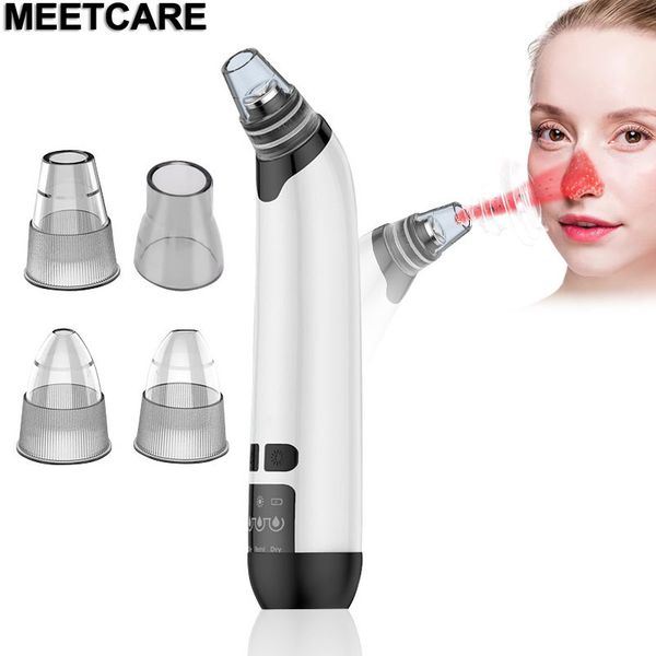 

blackhead vacuum suction pore vacuum cleaner facial blackhead acne removal tools 3 colors light pn rejuvenation skin care