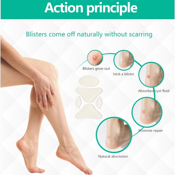 2019 Blister Prevention Patches For Runners Foot Pain High Heels Tennis Shoes Athletes Hydrocolloid Blister Patch 1 Box #746394 From Feiteng001, $27.6 2019 Blister Prevention Patches For Runners Foot Pain High Heels Tennis Shoes Athletes Hydrocolloid Blister Patch 1 Box #746394 From Feiteng001, $27.6