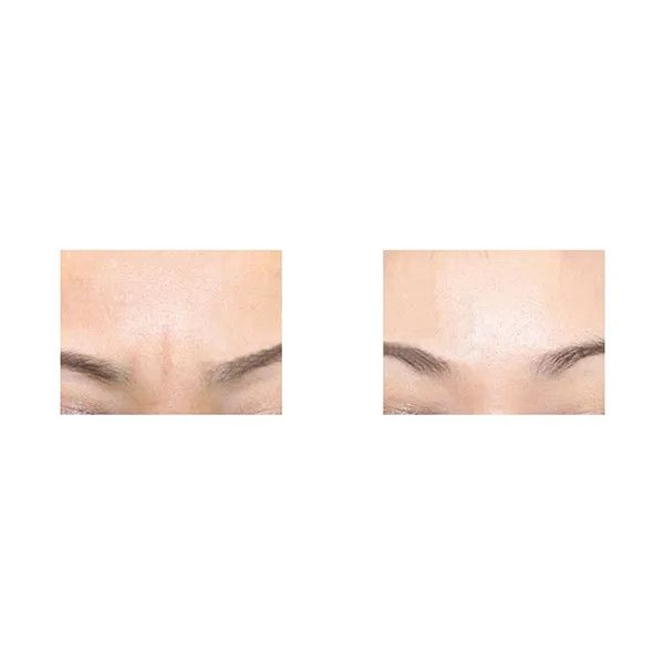 

Beauty Good effect skin care products for face