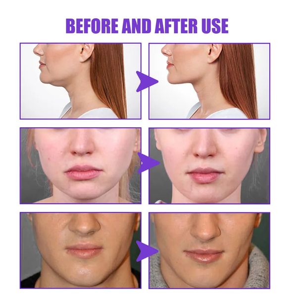 V-Shape Face Slimming Cream Effective Lifting Up V Double Chin Cheek Slimming Firming Reshaped Face Counter Anti-aging Skin Care