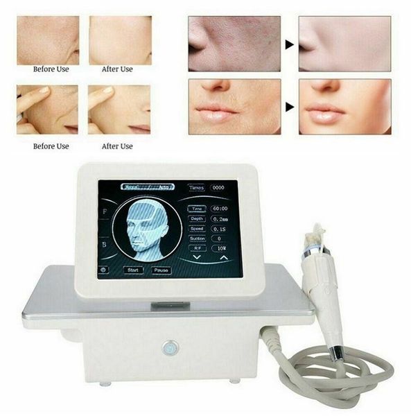 

fractional microneedle rf machine for acne scar stretch marks removal