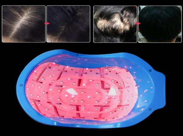 

new cap hair growth cap diodes hair loss treatment lllt hair loss regrowth growth therapy treatment machine6996600, Black