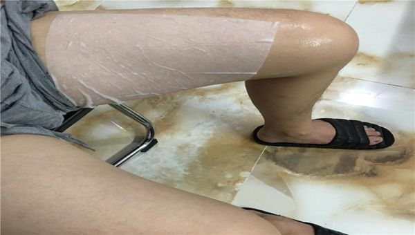

antize membranes ze fat anti cooling gel pad antize membrane for cryotherapy fat zing for skin5775335