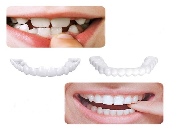 

upper lower teeth veneers denture simulation braces snap on perfect whitening 7890590