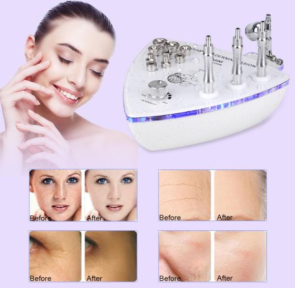 

diamond microdermabrasion dermabrasion machine with spray gun water spray vacuum suction diamond exfoliation spraying device facia5907728