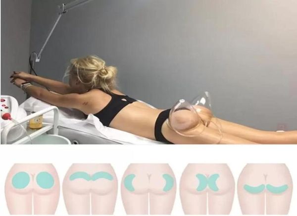 

slimmingeasy to use lifting body sculpting slimming vacuum therapy women breast enlargement lymph drainage suction cup3479990