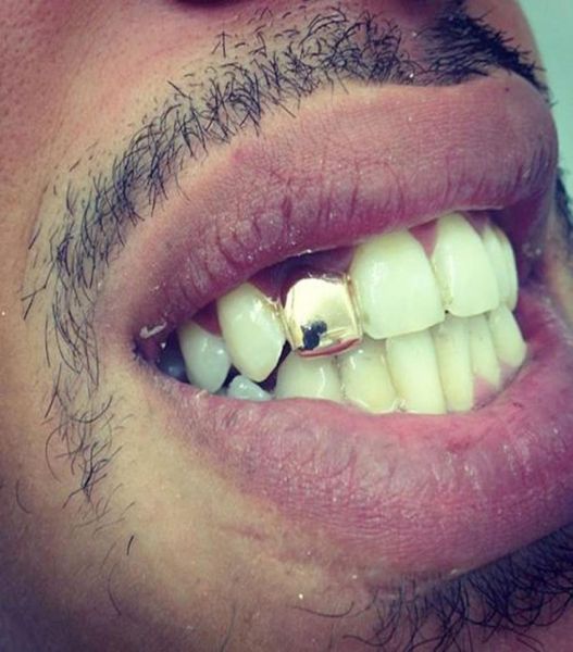 

hiphop custom gold plated single tooth cap hip hop jewelry braces rap singer jewelry teeth sets whole9747240, Black
