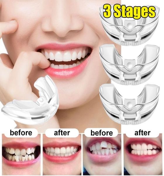 

1pc orthodontic braces appliance dental braces silicone alignment trainer teeth retainer bruxism mouth guard teeth straightener2041654, Black