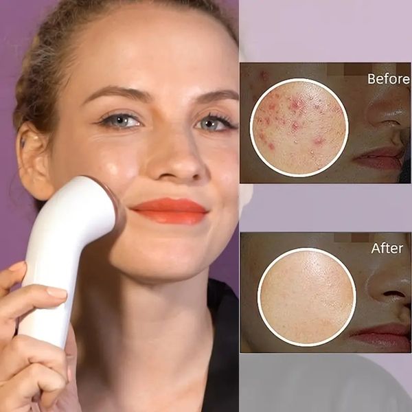 

plasma skincare device with cool led light therapy for wrinkles diminishing and facial beauty massage