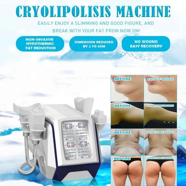 

4 silicone handles 4 controls 360 surround cryotherapy slimming machine cool tech sculpting body shape fat ing criolipolysis fat loss machin