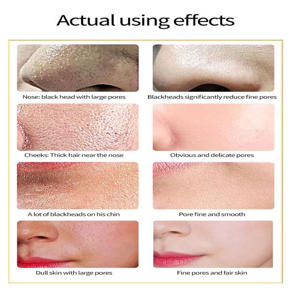 

set green tea blackhead removal mask deep cleansing shrink pores treatment acne pimple patch nose blackhead remove beauty s, Black;white