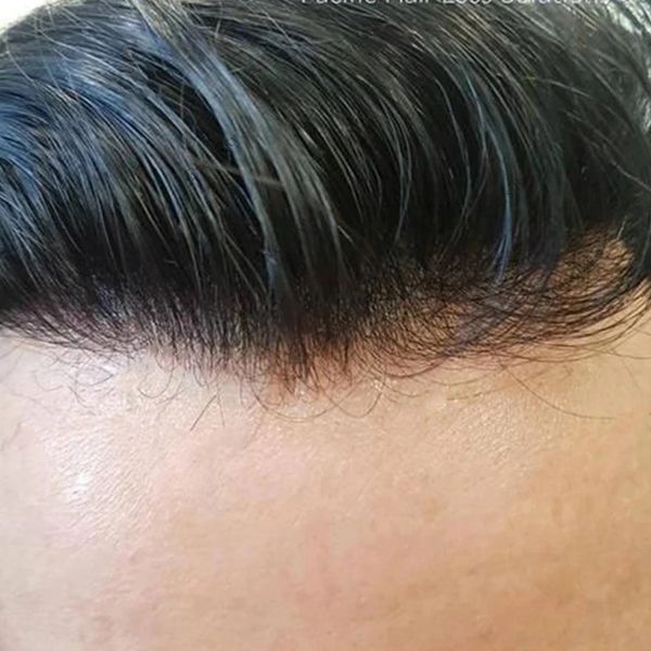 

mens toupee brown black remy hairpieces wigs replacement microskin unit natural hairline injected durable thickness full pu base
