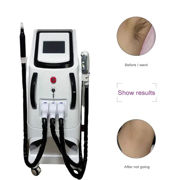 

beauty items 4 in 1 multi-function opt laser hair removal tattoo removal picosecond rf face lift beauty machine