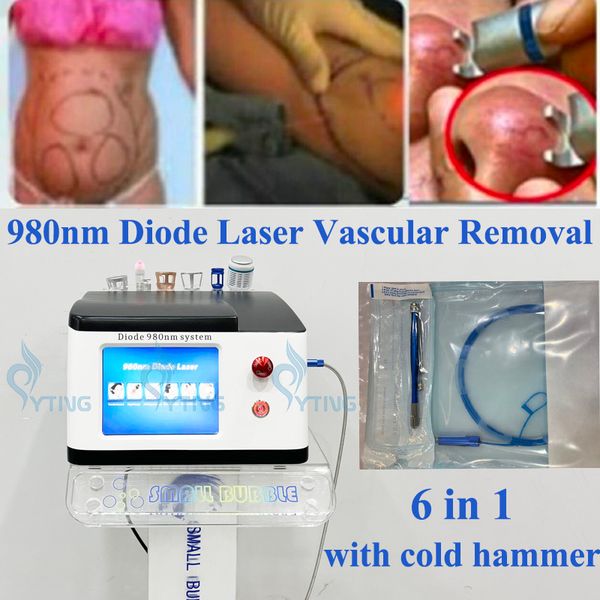 

980nm diode laser for vascular removal fat lipolysis physiotherapy pain treatment nail fungus removal 6 in 1 with cold hammer, Black
