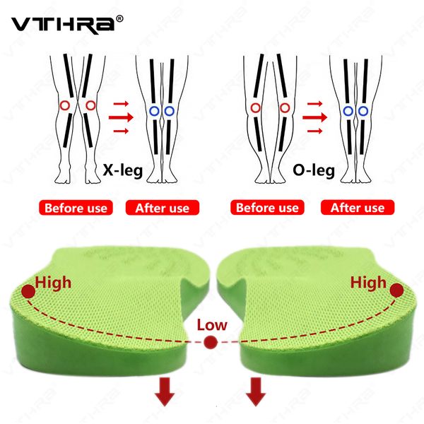 

shoe parts accessories o/x-leg orthopedic insoles arch support insole corrigibil bow legs valgus varus massaging shoe pads beauty leg feet c, White;pink