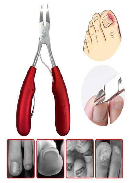 

nail clippers ingrown toenail podiatry correction nippers cuticle cutters cut paronychia pedicure manicure hand foot care tool4530994, Silver