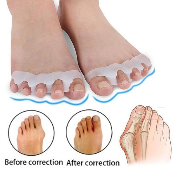 

hallux valgus braces toe separator overlapping toes rehabilitation treatment foot bone ortic device feet care silicone gel buni5065606