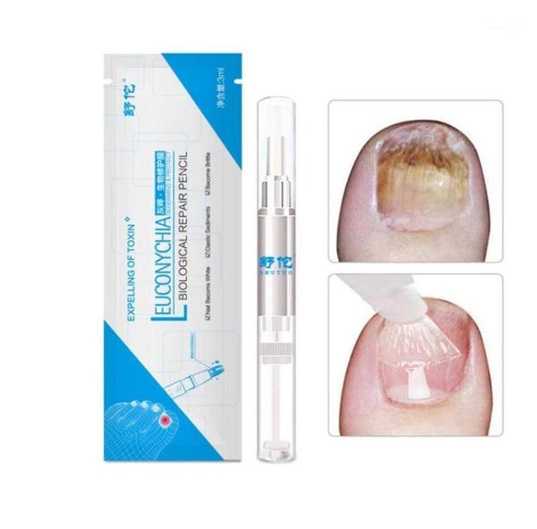 

pen nail repair fingernails toenails rich nutrition101235796461