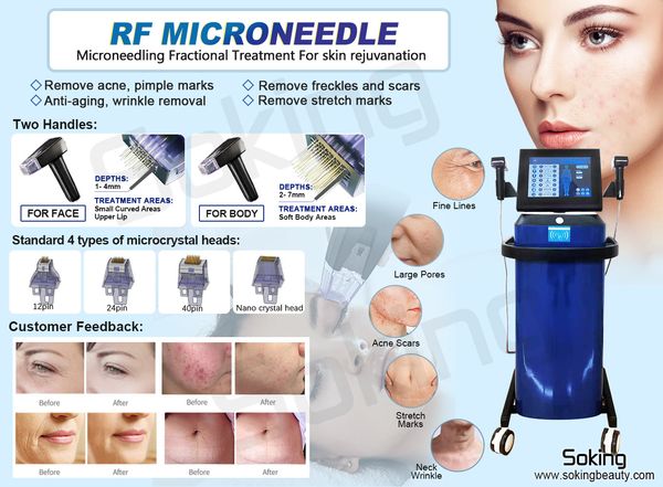 

high-end rf gold microneedle beauty machine fractional radio frequency micro needling skin tightening acne scars stretch marks removal for b