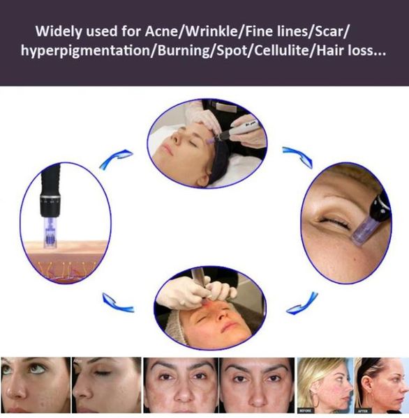 

professional derma roller pen micro needle meso pen drpen microneedle with different needles cartridge derma skin pen with factor6105450