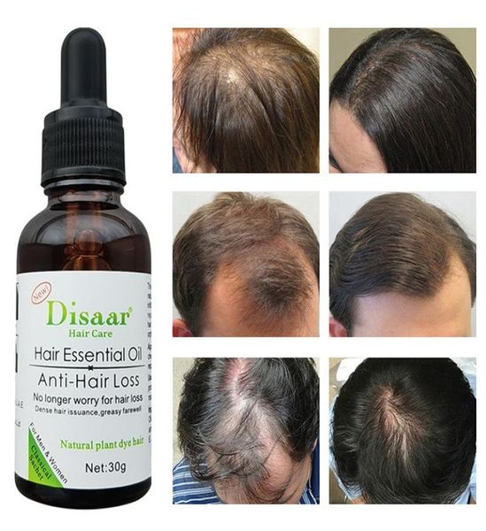 

hair loss products beauty health hair growth productshair loss product series follicles repairs hair growth plant ese8453039
