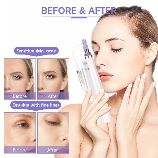 

hydra derma pen microneedle mesotherapy face hydrating skin anti ance pore shrink tightening rejuvenation meso gun