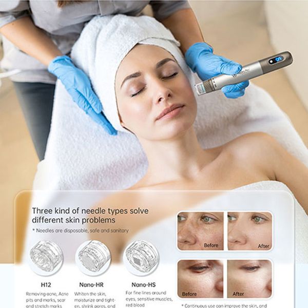 

6 speeds wireless pen h3 wireless rechargeable hydra pen h3 microneedling pen