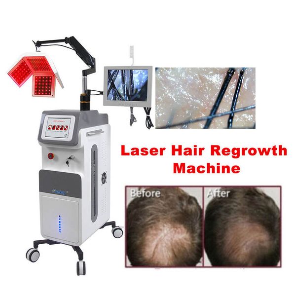 

hair growth machine 650nm laser anti hair loss treatment products detection painless hairs regrowth device high frequency hair analysis mach, Black