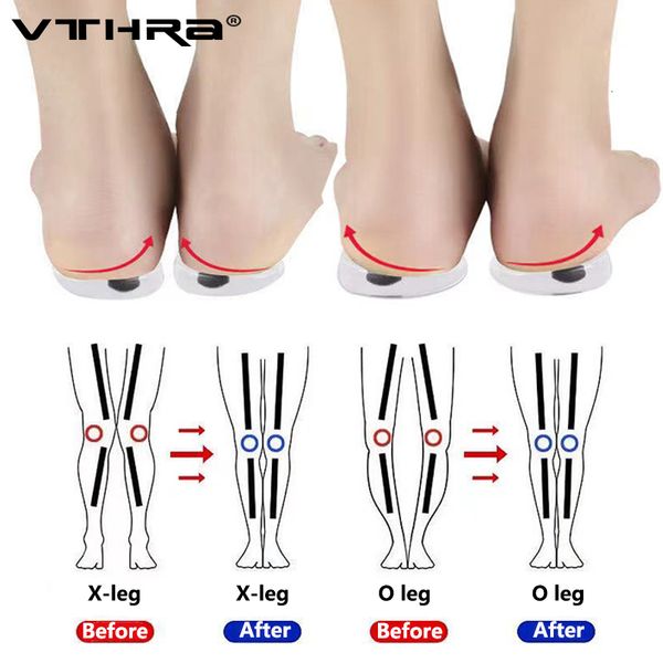 

shoe parts accessories 1 pair magnets silicon orthopedic insoles foot care tool for men women health o x type legs knee varus correction hee, White;pink