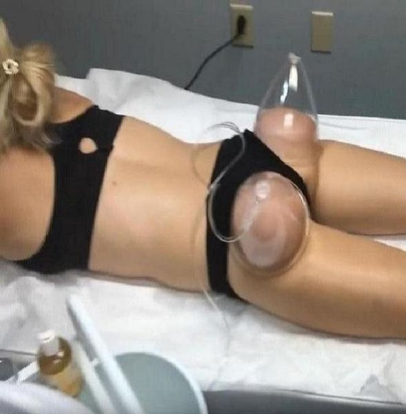 

slimming instrument butt lifting breast massager vacuum therapy cupping buttock enhancement enlargement machine1127370