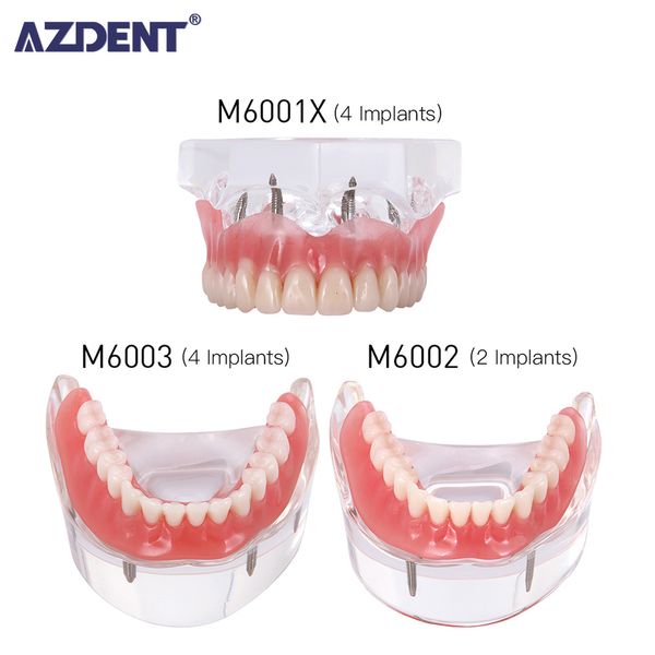 

Other Oral Hygiene Dental Implant Removable Denture Demo Disease Teeth Model with Restoration Bridge Teaching Study 230425