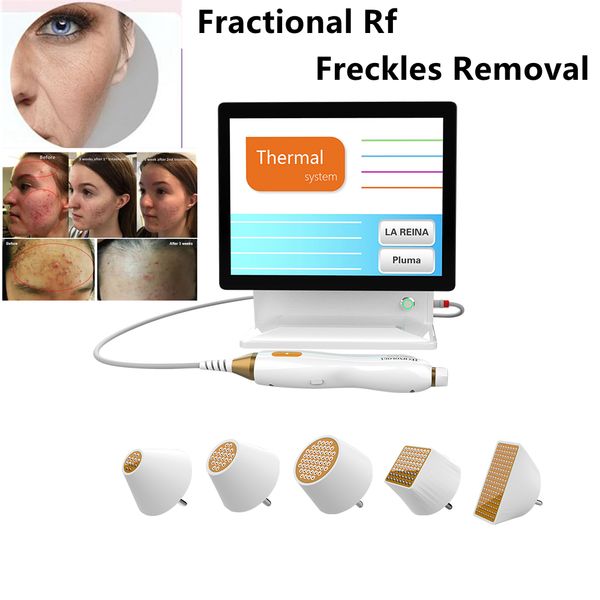 

portable rf face lifting machine microneedle freckles removal fractional rf micro needing scars removal gold rf microcrystalline care radio